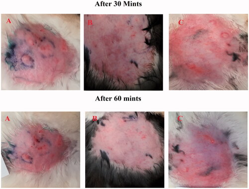 Figure 9. Effect of ebastine (emulgel) on group A and B versus group C after 30 min and 60 minutes.