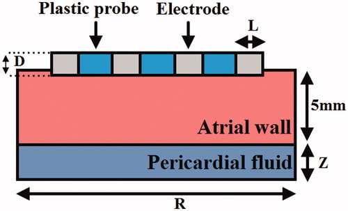 Figure 2. The geometry of computational model (not to scale). The thickness of atrial wall is 5 mm. Details of the electrodes are: Electrode diameter D = 2.31 mm (7 Fr), electrode lengths L= 3 mm, insertion depth 0.5 mm and electrode spacing 4 mm.