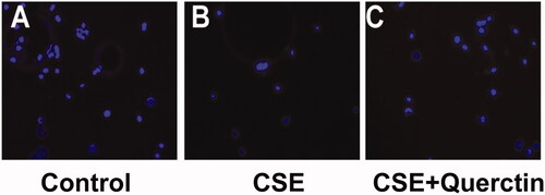 Figure 2. Quercetin protects RPE cells from CSE-induced apoptosis. (A) Control group, (B) CSE-treated group. (C) Quercetin and CSE-treated group.