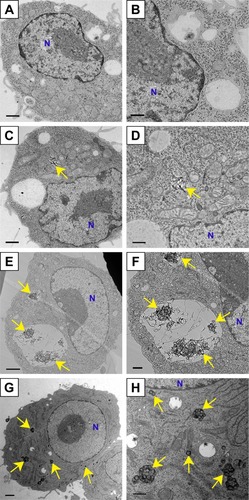 Figure 5 Transmission electron micrographs of RAW264 cells exposed to 100 µg/mL FT9110 and CNH uptake in dispersant (0.1% PS-DPBS).Notes: (A, B) Control, RAW264 cells exposed (C, D) FT9110 sonicated by W-140, (E, F) FT9110 sonicated by W-55. (G, H) CNHs sonicated by W-140. (A, C, E, G) Low magnification images. Scale bars correspond to 1 µm. (B, D, F, H) High magnification images. Scale bars correspond to 500 nm. The control was medium containing dispersant only. Yellow arrows indicate (C–F) FT9110 and (G, H) CNHs. Blue Ns indicate nuclei.Abbreviations: CNH, carbon nanohorn; DPBS, Dulbecco’s PBS; FT9110, Flotube 9110; PS, polysorbate 80.