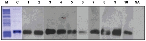 Figure 1 Western blot analysis of recombinant Par j 2 with ten sera from Parietaria judaica allergic patient (lanes 1–10). Lane NA shows incubation with a nonallergenic control serum. Lane C displays a Coomassie Brilliant Blue stained sodium dodecyl sulfate polyacrylamide gel electrophoresis of the purified recombinant Par j 2. Molecular weights are indicated in lane M.