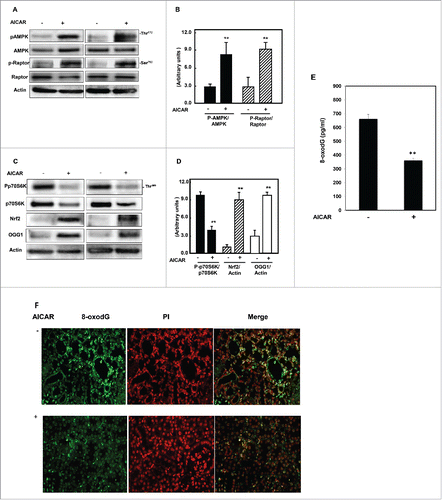 Figure 2. AICAR upregulates AMPK and inhibits mTORC1 to increase protein expression of Nrf2 and OGG1 and decrease 8-oxodG in kidney of diabetic mice. Immunoblot analysis shows that AICAR treatment increased phosphorylation of AMPK at Thr172 and resulted in significant decrease in mTORC1 measured by (A) increase in phosphorylation of raptor at Ser92 and (C) decrease in phosphorylation of p70S6k at Thr389 in kidney cortex of diabetic mice compared to non-treated mice. (C) Activation of AMPK resulted in significant increase in transcription factor Nrf2 and OGG1 protein expression in treated mice compared to non-treated mice. Actin was used as a loading control. (B&D) Histograms represent means ± SE (n = 4). (E) 8-OxodG levels were measured according to the instruction manual of 8-oxodG kits showed significant decrease in DNA damage in kidney of treated mice compared to non-treated mice. Significant difference from non-treated mice is indicated by **P < 0.01. Kidney sections of db/db mice (F) treated or non-treated with AICAR were stained with 8-oxodG antibody followed by FITC-anti-rabbit IgG as secondary antibodies. Staining of nucleus with propidium Iodide (PI) (red) and 8-oxodG with FITC (green) were detected using a filter with excitation range 450–490 nm and excitation at 535 nm.