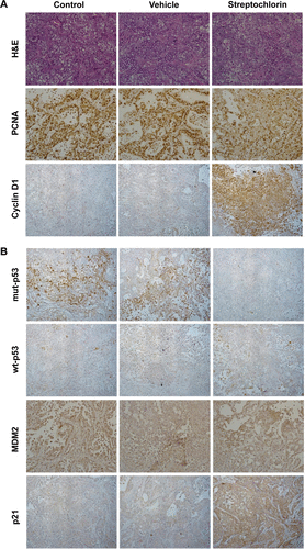 Figure S2 Immunohistochemical staining of solid tumor tissue in an animal tumor model in Figure 5A.