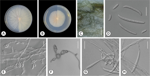 Figure 4. Fusarium rhizicola. A–B. Colony morphology after 8 d growth on PDA using a 12/12 h photoperiod. Colony surface is shown on left half of each plate and colony undersurface on right half. A. KG327. B. KG483. C. Sporodochia of KG327 formed on carnation leaf. D–H. KG483. D. 0-septate and multiseptate aerial conidia. E–F. Microconidia in false heads on monophialides. G–H. Aerial conidia developed on monophialides. Bars: C = 1 mm; D–H =20 μm.