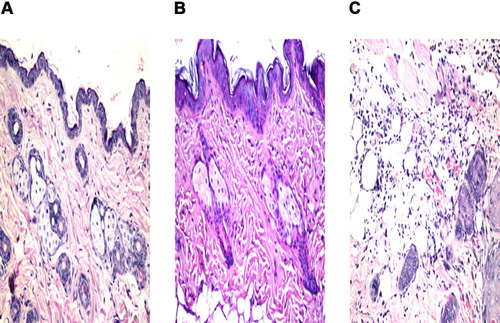 Figure 8 Photomicrographs showing histopathological sections (H&E stained) of (A) rat skin treated with normal saline (B) rat skin treated with optimized bilosomal gel and (C) rat skin treated with isopropanol (positive control).