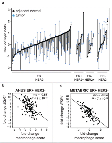 Figure 3. Stronger estrogen pathway expression in ER-positive tumors is associated with lower tumor inflammation (a) Macrophage pathway expression score in paired adjacent normal (black points) and tumors (blue points) in ER-positive/HER2-negative, ER-positive/HER2-positive, ER-negative/HER2-positive, and ER-negative/HER2-negative patients. Samples from the same patient are connected by a vertical line. The majority of ER-positive tumors express lower levels of macrophage markers than their matched adjacent normal tissue. (b,c) Fold-change in expression of ESR1 plotted against fold-change in macrophage score in ER-positive HER2-negative (b) AHUS and (c) METABRIC samples, demonstrating a significant inverse linear relationship.