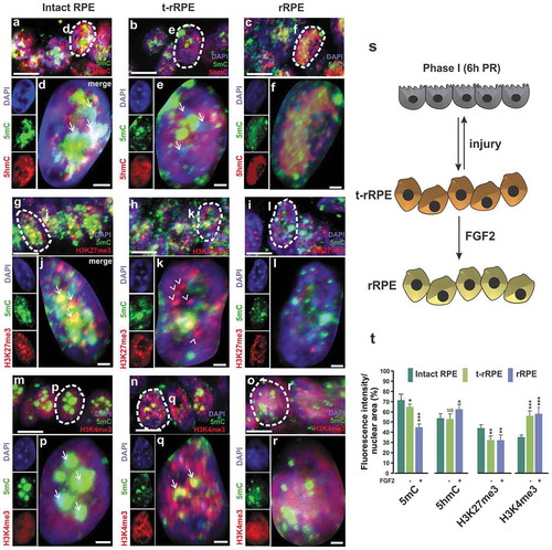 Figure 3. Early re-patterning and differential levels of histone and DNA modifications in t-rRPE and rRPE. Immunofluorescence staining and high-resolution three-dimensional (HR-3D) reconstruction confocal microscopy of histone modifications associated with bivalent chromatin (H3K27me3/H3K4me3) and DNA modifications (5mC and 5hmC) in (a, g, m) intact RPE at stage 23–25, (b, h, n) transient reprogrammed RPE (t-rRPE) and (c, i, o) reprogrammed RPE (rRPE) at 6 h PR. Single channels and merged views of the dotted areas are shown for each condition and combination of marks. Arrows in d, j and p indicate heterochromatic areas. Arrows in e show 5mC out of heterochromatic regions. Arrowheads in k show the marks do not co-localize in t-rRPE. Arrows in q indicate co-localization of epigenetic marks. All images were processed in parallel and imaged using the same confocal settings. Scale bars in a-c, g-i, m-o are 5 μm. Scale bars in d-f, j-l, p-r are 1 μm. (s) Model of early RPE reprogramming (Phase I; 6 h PR). RPE is transiently reprogrammed (t-rRPE) in response to injury signals (e.g., retinectomy) and in the absence of FGF2. The reprogrammed RPE (rRPE) is generated in the presence of FGF2. (t) Quantification of the percentage of fluorescence intensity per nuclear area of epigenetic marks in the t-rRPE or rRPE at 6 hPR, compared to intact RPE. * = p < 0.05, *** = p < 0.001. Student’s t test. NS, non-significant. Means ± standard error is shown.