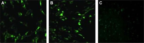 Figure 1 Transfection of cells under fluorescence microscope.