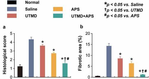 Figure 3. Chronic effects of combined APS microbubbles with UTMD on the cardiomymorphology of the DCM rats. (a) Histological score and (b) fibrotic area of heart tissues from the rats in different groups. All results showed as Mean ± SD (n = 6). * P < 0.05 vs. Saline group; † P < 0.05 vs. UTMD alone group; # P < 0.05 vs. APS alone group.