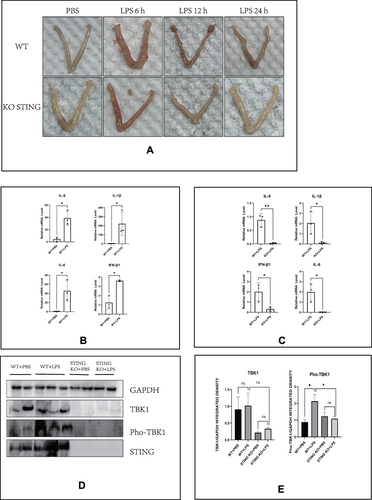 Figure 5 Intrauterine infusion of LPS induces uterine hyperemia and cGAS-STING pathway activation in mice. (A) Representative images of the uterus of mice after intrauterine infusion in indicated groups. (B) The relative mRNA levels of IL-8, IL-1β, IL-6, and IFN-β1 by RT-PCR in indicated groups of the uterus of mice (LPS: 12 h). (C) Quantitative analysis of (B). (D) The protein levels of TBK1 and Pho-TBK1 (LPS: 6 h). (E) Quantitative analysis of (D). (*p < 0.05).