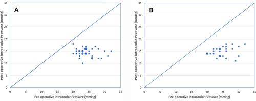 Figure 2 Scatterplot of pre-operative intraocular pressure (IOP) versus post-operative IOP. (A) Month 12. (B) Month 24. Small circles represent a single eye. Intermediate circles, 2 eyes. Large circle, 3 eyes. Points below the diagonal represent a reduction in IOP from pre-operative baseline.