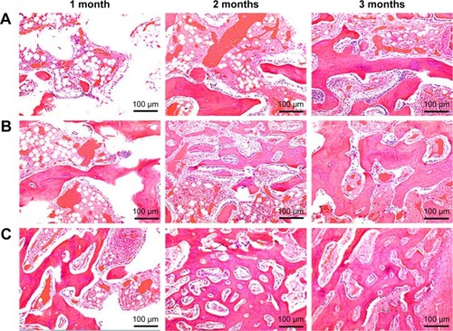 Figure 7 H&E staining of histological sections of GL (A), 15nDGC (B) and 30nDGC (C) scaffolds implanted into femoral defects for 1, 2 and 3 months.Abbreviations: GL, gliadin; H&E, hematoxylin and eosin.