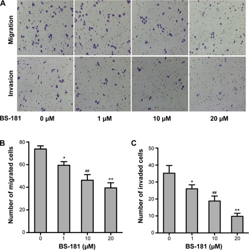 Figure 1 BS-181 decreased the migration and invasion ability of BGC823 cells.