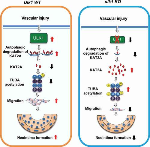 Figure 8. Proposed scheme for the role of ULK1 in neointima formation following vascular injury. Deletion of Ulk1 in VSMCs results in KAT2A accumulation and thus increases TUBA acetylation, which inhibits VSMC migration and neointima formation through modulating microtubule stability and cell motility