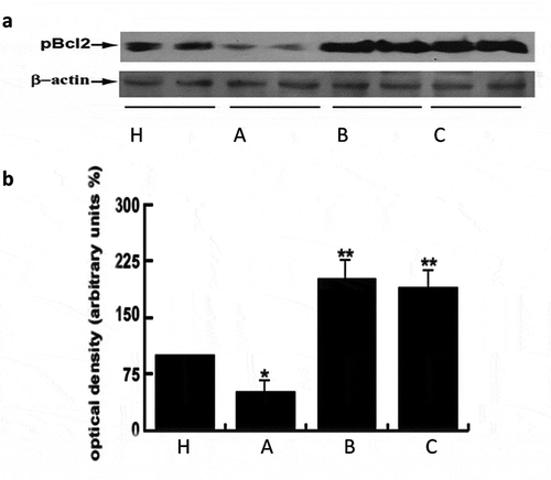 Figure 3. Nutraceuticals mix and MI induced Bcl2 phosphorylation. Panel A) 70 μg of sperm protein lysates were used for western blot analysis of Bcl2 phosphorylation. Healthy volunteer’s donors were used as positive control (H). A = OAT untreated patients, B = sperm from OAT patients treated in vitro with MI; C = OAT patients treated in vivo with the supplement mentioned above. For each group three different pooled samples were used. β-actin was used as loading control. Panel B) Densitometric evaluation of the bands