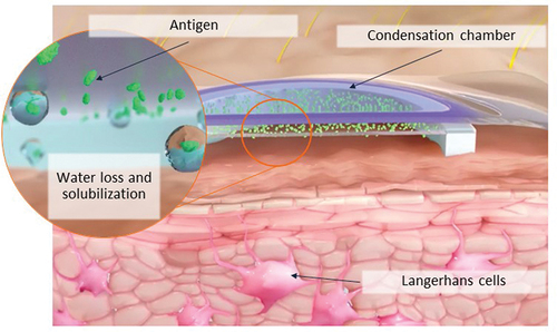 Figure 1. Overview of mechanism of action with the peanut patch.The peanut patch contains 250 µg of dried peanut protein on a film disc that is placed on top of a doubled-sided adhesive foam ring. When placed on the skin the film disc and foam ring, which are held in place by an adhesive overlay, form a condensation chamber. Natural water loss from the skin leads to solubilization of the peanut allergen which is taken up by antigen-presenting cells, such as Langerhans cells, in the superficial layers of the non-vascularized epidermis.