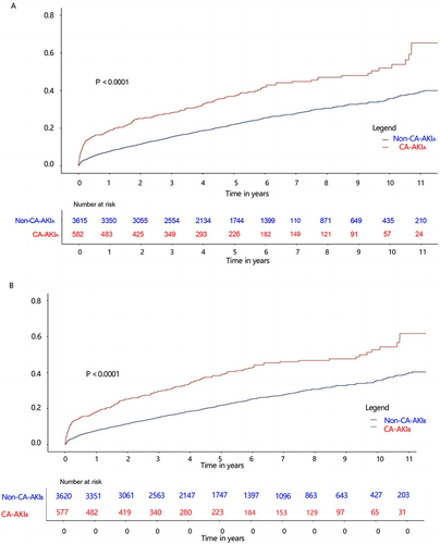 Figure 1 Kaplan-Meier curves for the long-term prognosis of patients with CA-AKI and without CA-AKI. (A) Kaplan-Meier for the long-term prognosis of patients with CA-AKIA and without CA-AKIA. (B) Kaplan-Meier for the long-term prognosis of patients with CA-AKIB and without CA-AKIB.
