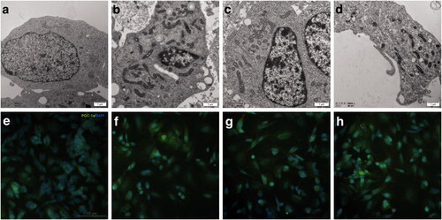 Figure 6. Ultrastructural images of mitochondria and the expression of PGC-1a during RAs-induced neural differentiation of SH-SY5Y cells. (a) SH-SY5Y cells treated with DMSO for 7 days shows dotted or spherical mitochondria with immature cristae. (b–d) SH-SY5Y cells treated with 9-cis-RA, 13-cis-RA and at-RA, respectively for 7 days shows increased and long strip-shaped mitochondria with well-developed mitochondria cristae. (e–h) Expression of PGC-1a on SH-SY5Y cells treated with DMSO, 9-cis-RA, 13-cis-RA and at-RA, respectively for 7 days.