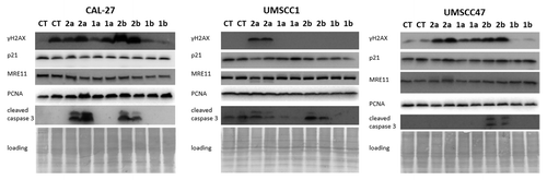 Figure 4. Expression of γH2AX, PCNA, MRE11, p21, and cleaved caspase 3 in CAL27, UMSCC1 and UMSCC47 oral squamous cell carcinoma lines treated with 1a, 1b, 2a, and 2b antioxidants. CT, control tissues; 1a, 1b, 2a, 2b, tissues treated with antioxidants. Antioxidants: 1a, 6′-hydroxy-2′,5′,7′,8′-tetramethylchroman-2′-yl) methyl 3,4,5-trihydroxybenzoate; 1b, 6′-hydroxy-2′,5′,7′,8′-tetramethylchroman-2′-yl) methyl 3,5-dimethoxy-4-hydroxycinnamate; 2a, N-decyl-N-(3,5-dimethoxy-4-hydroxybenzyl)-3-(3,4-dihydroxyphenyl) propanamide; 2b, N-decyl-N-(3-methoxy-4-hydroxybenzyl)-3-(3,4-dihydroxyphenyl) propanamide.