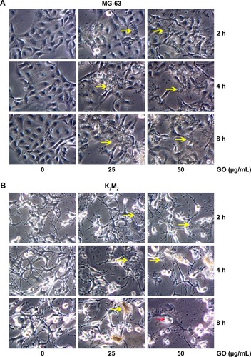 Figure 3 Morphology detection of GO in MG-63 and K7M2 cells.Notes: (A) MG-63 and (B) K7M2 cells were treated with 0, 25, 50 µg/mL GO (without FBS) for 2, 4, and 8 h. Yellow arrows: GO material. Red arrows: K7M2 cells with large vacuoles.Abbreviations: FBS, fetal bovine serum; GO, graphene oxide.