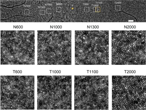 Figure 4 Panoramic and focal adaptive optics images of the macular area in one eye for the healthy controls.