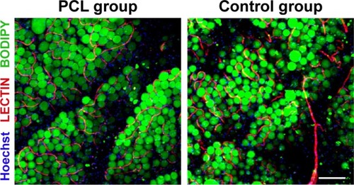 Figure 5 Visualization of engineered adipose tissue at week 12 by whole-mount staining.Notes: Interaction of blood vessels and adipocytes in engineered adipose tissue (PCL group) was demonstrated by Lectin/BODIPY/Hoechst (red/green/blue) staining and compared with adipose tissue in control group. At baseline, capillaries or vessels ran between mature adipocytes in both groups, and adipose tissue in the PCL group displayed a more mature and integrated structure than the control group. Scale bar =200 μm.Abbreviation: PCL, polycaprolactone.