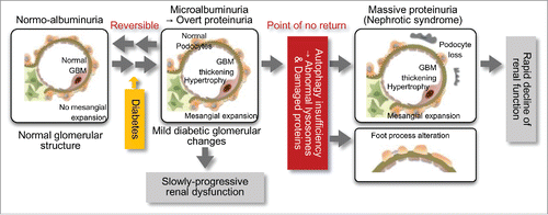 Figure 1. Autophagy insufficiency is associated with the pathogenesis of podocyte injury and massive proteinuria in diabetic nephropathy. Diabetes alone results in the development of mild glomerular lesions, such as glomerular hypertrophy, basement membrane (GBM) thickening, mild mesangial expansion and minimal proteinuria, leading to slowly-progressive renal dysfunction. However, the combination of insufficient podocyte autophagy and diabetic conditions results in podocyte loss, foot process alterations and lysosome dysfunction. This results in massive refractory proteinuria and a rapid decline of renal function. Autophagy insufficiency-related podocyte loss may be involved in the "point of no return" in diabetic nephropathy.