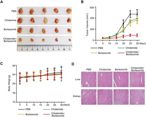 Figure 7 Antitumor effects of chidamide alone or in combination with bortezomib on MGC-803 cells in vivo. Nude mice bearing MGC-803 tumors (∼100 mm3) were divided into four groups and treated with PBS, chidamide (25 mg·kg−1·day−1), bortezomib (0.5 mg·kg−1, every 3 days), or a combination of chidamide and bortezomib for 30 days. Tumor growth (A), tumor volumes (B) and body weight (C) were measured. Results are shown as mean ± SEM (n = 5). (D) Paraffin sections of kidney and liver of MGC-803 xenografts were stained with hematoxylin and eosin. Sections were examined by light microscopy (100 × magnification).