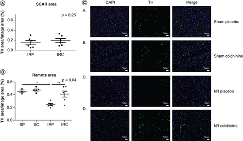 Figure 2. Sympathetic nerves quantification in the scar (A) and remote (B) areas of ischemic hearts on immune-fluorescence, with a typical example of remote area immunofluorescence (C).SP; SC; IRP; IRC; TH (specific antibody for sympathetic nerves immune-fixation); Note the important denervation in the remote area after myocardial infarction, reversed by Colchicine.*p < 0.05.IRC: IR colchicine; IRP: IR placebo; SC: Sham colchicine; SP: Sham placebo; TH: Tyrosine hydroxylase.