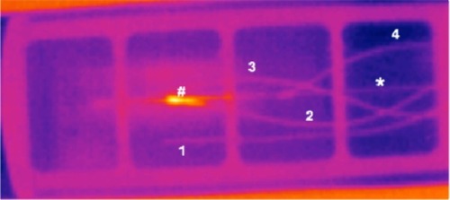 Figure 9 Thermal image of an interventional device seconds after removing it from an MPI scanner.Notes: Phantom (pink frame) allows exact positioning of instruments (*) and temperature sensors (1 to 4) inside the bore of the MPI scanner. Reference sensor has no contact to instruments. The other sensors measured heating at the FFP (2) and also distal (3) and proximal (4) of the FFP. Hotspot of punctual heating is shown at the FFP (#) in an instrument with ferromagnetic characteristics.Citation82Abbreviations: MPI, magnetic particle imaging; FFP, field-free point.
