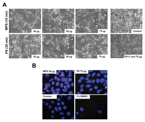 Figure 1 Biotolerability of nanoparticles. NIH-OVCAR3 cells adherent on coverslips were incubated with 10 nm naked mesoporous silica or 30 nm COOH-polystyrene nanoparticles (at the indicated concentration) in fresh medium for 48 hours. Thereafter, the monolayers were extensively washed to remove the excess of unbound nanoparticles and (A) imaged under the phase-contrast microscope to document gross morphological alterations or cell loss, and (B) labeled with CellTracker™ to show metabolic effects.Note: Positive control of toxicity was performed by incubating the cells with 1% dimethyl sulfoxide.