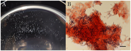 Fig. 1 Co-aggregation between E. coli MG1655 and L. casei NBRC3831 on a Polystyrene Dish.Note: Unstained co-aggregates (A) and Gram-stained co-aggregates (B) are shown. Scale bar, 10 μm.