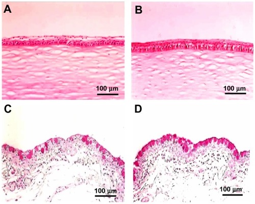 Figure 3 Light microscopic images showing the structure of the cornea stained with HE (A and B), and the lower tarsal conjunctiva stained with PAS (C and D). Corneal epithelium and conjunctival epithelium were recovered, goblet cells were increased at 7 days after treatment with 1500 IU/mL of VApal (B and D) compared with vehicle-treated eye (A and C).