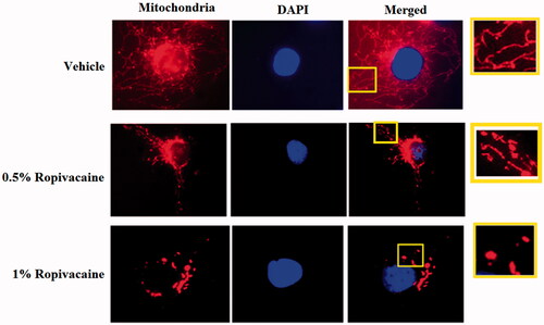 Figure 1. Ropivacaine induces fission-like changes in mitochondrial morphology. Human SH-SY5Y neuronal cells were treated with 0.5% and 1% ropivacaine for 72 h. Mitochondrial morphology was measured by MitoTracker red staining; nuclei were stained with DAPI. The overlay pictures were shown to overall mitochondrial morphology. The insets were amplified mitochondrial structure.