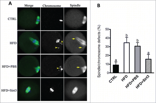 Figure 4. Sirt3 overexpression ameliorates the meiotic defects in oocytes from HFD mice. (A) MII oocytes were stained with α-tubulin antibody to visualize the spindle (green) and counterstained with Hoechst 33342 to visualize chromosomes (blue). Normal metaphase oocytes present a typical barrel-shape spindle and well-aligned chromosomes on the metaphase plate. Spindle defects and chromosome misalignment are indicated by arrows and arrowheads, respectively. Representative confocal sections are shown. (B) Quantification of control (n = 180), HFD (n = 182), HFD+PBS (n = 196) and HFD+Sirt3 (n = 203) MII oocytes with spindle defects or chromosome misalignment. Data are expressed as mean percentage ± SD from 3 independent experiments. Different superscripts indicate significant values (P < 0.05). Scale bar: 30 µm.