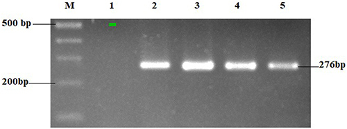 Figure 3 Electrophoresis results of AR gene amplification. Land 1: Negative control; Land 2: Father sample; Land 3: Mother sample; Land 4: Affected child sample; Land 5: Embryo A1 sample; Land (M) Ladder 100bp.