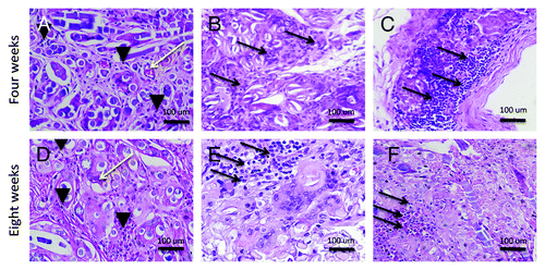 Figure 2. Local inflammatory reaction. (A) H&E staining of unseeded PGA scaffold (400×). (B) H&E staining of ADSCs seeded scaffold (400×). (C) H&E staining of MDSCs seeded scaffold (400×). (D) H&E staining of unseeded PGA scaffold (400×). (E) H&E staining of ADSCs seeded scaffold (400×). (F) H&E staining of MDSCs seeded scaffold (400×). Black arrowheads, polimorphonuclear cells; black arrows, lymphocytes; yellow arrow, blood vessels.