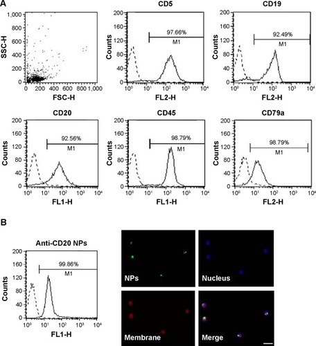 Figure 2 CLL patients’ cell characterization and NP binding.Notes: (A) Cells 5×105 were incubated with PE-conjugated anti-CD5 or anti-CD79a; and FITC-conjugated anti-CD19 and anti-CD45 antibodies. The expression of CD20 on the surface of cells was confirmed using an anti-CD20 primary antibody and a FITC-conjugated antihuman secondary antibody. Samples were analyzed by FACSCalibur flow cytometer and data were analyzed by CELLQuest software. (B) FITC-conjugated NPs (green fluorescence) and cells labeled with Fast-DiI (red fluorescence) were incubated for 1 hour at 37°C. NPs’ binding was evaluated by cytometric analysis. DAPI was used to label nuclei (blue fluorescence) and samples were analyzed with a Leica DM2000 optical Microscope. Original magnification 100×.Abbreviations: CLL, chronic lymphocytic leukemia; FITC, fluorescein isothiocyanate; FL1-H, green fluorescence, 530/30 nm bandpass filter; FL2-H, orange fluorescence, 585/42 nm bandpass filter; M1, Marker 1; NP, nanoparticle; PE, Phycoerythrin; SSC-H, side scatter height.