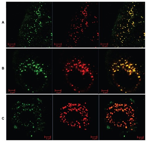 Figure 9 Confocal images of Nile red-labeled and NBD-labeled liquid crystalline nanoparticles in Caco-2 cells. (A) Most NBD colocalized with Nile red at 30 minutes, (B) NBD still colocalized with Nile red, and partly separated from Nile red at 90 minutes, and (C) most NBD separated with Nile red and inserted into the cell membrane at 240 minutes. Red, Nile red; green, NBD-PE.Abbreviations: NBD, N-(7-nitrobenz-2-oxa-1, 3-diazol-4-yl)-1; NBD-PE, N-(7-nitrobenz-2-oxa-1, 3-diazol-4-yl)-1, 2-dihexadecanoyl-sn-glycero-3-phosphoethanolamine.