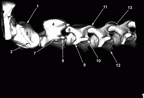 Figure 1.  Three-dimensional (3D) reconstructed CT image of the cervical spine viewed from the lateral aspect. 1. Dorsal arch of atlas. 2. Transverse process (wing) of atlas. 3. Transverse foramen of atlas. 4. Spinous process of axis. 5. Caudal articular process of axis. 6. Transverse process of axis. 7. Transverse foramen of axis. 8. Cranial articular process of third vertebra. 9.·Ventral tubercle of transverse process of third vertebra. 10. Dorsal tubercle of transverse process of third vertebra. 11. Caudal articular process of third vertebra. 12. Ventral crest on the body of cervical vertebrae. 13. Joint between articular processes.