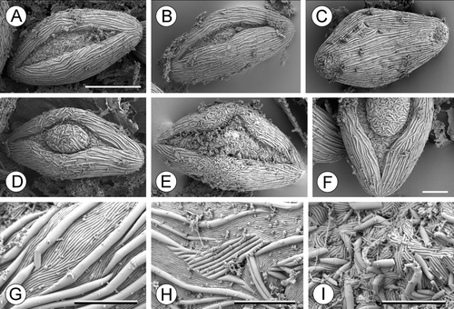 Figure 12. A–I. SEM, pollen grains of Cabomba aquatica: (A, B) Pollen grains viewed from distal side; aperture without operculum; (C) pollen grain from proximal side; (D) pollen grain from distal side; aperture without operculum; (E) trichotomosulcate pollen grain; (F) detail of a grain with an operculum; (G) exine sculpturing in non‐apertural region on the distal side of the same pollen grain as in (A); (H) exine sculpturing in non‐apertural region on proximal side; (I) sculpturing of the aperture of the same pollen grain as in (A). Scale bars – 30 µm (A–E); 10 µm (F); 4 µm (G); 5 µm (H); 4 µm (I).