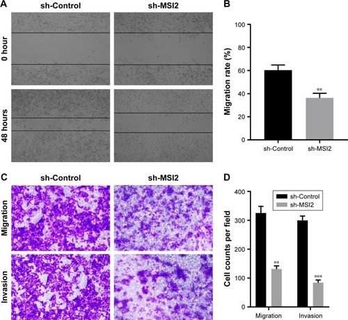 Figure 4 MSI2 promotes the migration and invasion of extrahepatic cholangiocarcinoma.