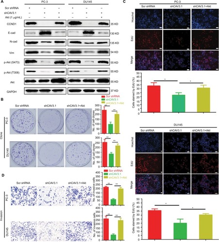 Figure 5 Ectopic expression of Akt reversed the inhibitory effects on proliferation and invasion of PCa cells caused by CAV3.1 knockdown.Notes: (A) Ectopic expression of Akt antagonized the effects of CAV3.1 knockdown on CCND1, E-cad, N-cad, Vim, p-Akt (S473), and p-Akt (T308) in PCa cells. Ectopic expression of Akt reversed the clone number (B), EdU incorporated rates (C), and invasive cells (magnification ×200) (D) in PC-3 and DU145 cells with CAV3 (magnification ×100).1 knockdown. *P<0.05, **P<0.01.Abbreviations: E-cad, E-cadherin; EMT, epithelial–mesenchymal transition; GAPDH, glyceraldehyde-3-phosphate dehydrogenase; N-cad, N-cadherin; PCa, prostate cancer.