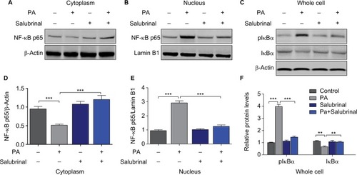 Figure 4 Salubrinal inhibits the activation of hypothalamic NF-κB pathway induced by PA treatment.