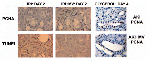 Figure 2 Renal cell proliferation and apoptosis in rats with AKI induced by ischemia-reperfusion and in mice with AKI induced by glycerol injection, untreated or treated with MVs derived from human MSCs. (A) Representative micrographs of PCNA staining and TUNEL assays performed on sections of kidneys 2 days after IRI, treated or not with 30 µg of MVs. Magnification: x400. (B) Representative micrographs of PCNA staining performed on sections of kidneys 4 days after glycerol injection, treated or not with 15 µg of MVs. Magnification: x400. (Described in ref. Citation14).