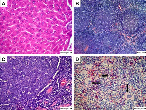 Figure 8 Histopathological changes in metoclopramide nanoparticle–treated group.Notes: (A) Liver shows normal hepatic cords; (B) lymph nodes show follicular hyperplasia; (C) lymphoid follicles heavily populated with small lymphocytes; (D) spleen shows extramedullary formation of hematopoietic cells (arrow) and hemosiderosis (notched arrow); H&E.
