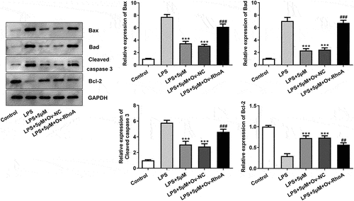 Figure5. Carvedilol affects the expression levels of apoptosis-related proteins in LPS-induced BEAS2B cells by inhibiting RhoA/ROCK activities. The expression of apoptosis-related proteins, including Bax, Bad, cleaved caspase3 and Bcl-2 in LPS-induced BEAS2B cells transfected with Ov-RhoA. ***P < 0.001 Versus LPS. ##P < 0.01, ###P < 0.001 Versus LPS+5 µM+Ov-NC.