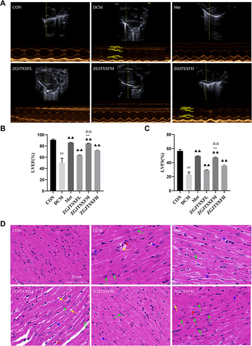 Figure 6 ZGJTSXF administration changed myocardial function and myocardial histology in DCM mice. (A–C) Echocardiographic observation of changes in cardiac function in various groups of mice. (A) Representative M-mode echocardiograms in mice of the indicated groups. (B) Summary on the left ventricular fractional shortening (FS). (C) Summary on the left ventricular ejection fraction (EF). ##P<0.01, compared with the CON group; ▲▲P<0.01, compared with the DCM group; **P<0.01, compared with the ZGJTSXFL group; ΔΔP<0.01, compared with the ZGJTSXFH group. (D) Histopathological changes in myocardial tissues of mice in the indicated groups were observed by HE staining (Scale bar, 20 μm). (a) CON group; (b) DCM group; (c) Met group, (d) ZGJTSXFL group; (e) ZGJTSXFM group; (f) ZGJTSXFH group. Green arrow, cardiomyocyte hypertrophy; red arrow, small focal inflammatory cell infiltrates in the interstitial myocardium; blue arrow, vacuolar degeneration of cardiomyocytes; yellow arrow, thickening of the capillary basement membrane.