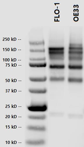 Figure 2 Phospho-tyrosine detection of OE-33 and FLO-1 cell lines using immunoprecipitation. Cell lysates of esophageal cancer cell lines were immunoprecipitated with anti-phospho-tyrosine antibody PY20 and then blotted with the same antibody to maximize detection of tyrosine phosphorylated protein bands.