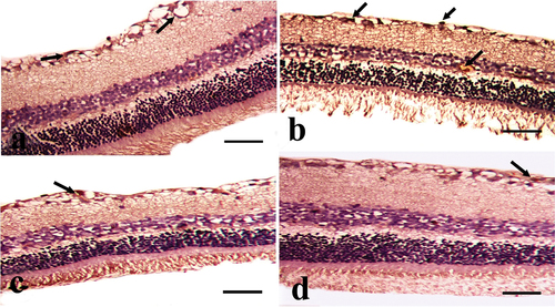 Figure 6. A photomicrograph of the cross section of the rat retina in the experimental groups (anti-S100 immunostain). A: CONT group showing mild positive expression (black arrow), especially in the nerve fiber layer (NFL) and ganglion cell layer (GCL). B: STZ group showing marked positive expression (black arrow), especially in NFL, GCL, and inner nuclear layer. C: the STZ+MTF group shows moderate positive expression (black arrow), especially in the NFL and GCL. D: STZ+ MTF-NE group showing moderate S-100 positive expression (black arrow), especially in NFL and GCL. (Scale bar = 50µm).